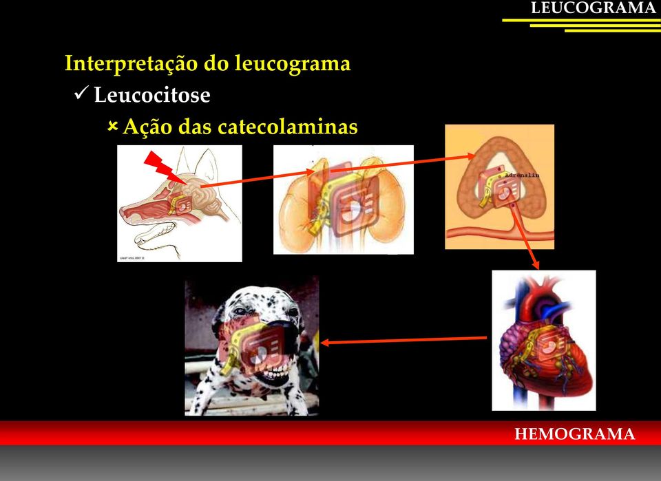 Leucocitose