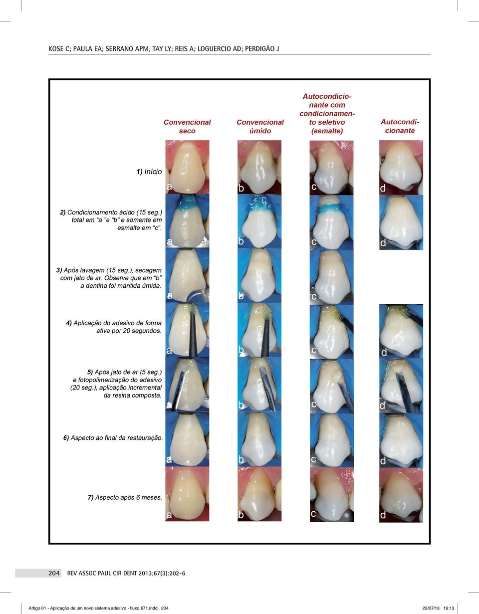 dent 2013;67(3):202-6 Artigo 01 - Aplicação de um