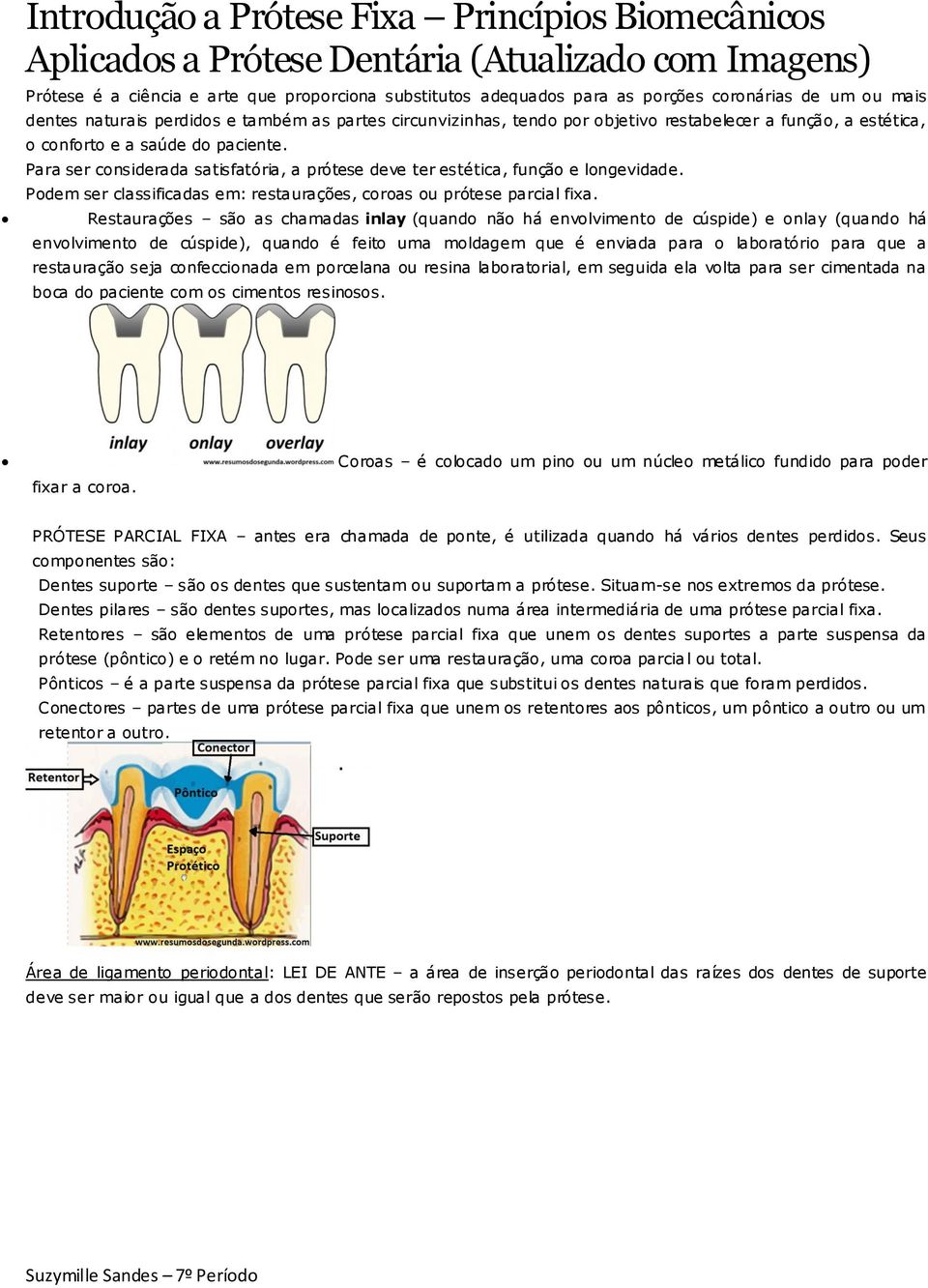 Para ser considerada satisfatória, a prótese deve ter estética, função e longevidade. Podem ser classificadas em: restaurações, coroas ou prótese parcial fixa.