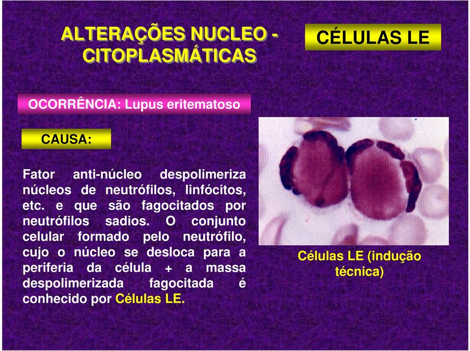 e que são fagocitados por neutrófilos sadios.