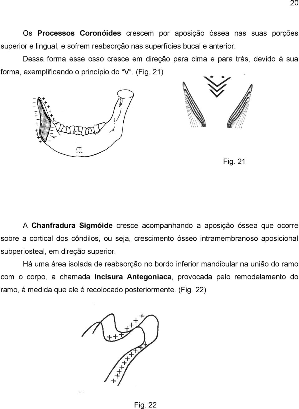 21 A Chanfradura Sigmóide cresce acompanhando a aposição óssea que ocorre sobre a cortical dos côndilos, ou seja, crescimento ósseo intramembranoso aposicional subperiosteal,