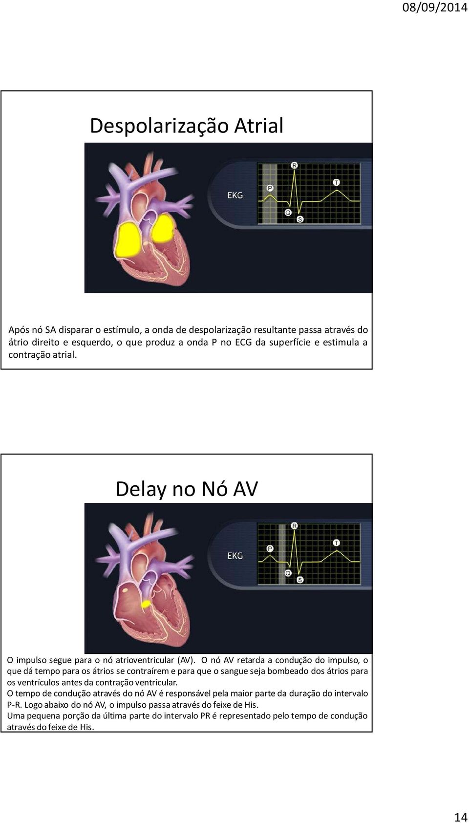 O nó AV retarda a condução do impulso, o quedátempoparaosátriossecontraíremeparaqueosanguesejabombeado dosátriospara os ventrículos antes da contração ventricular.