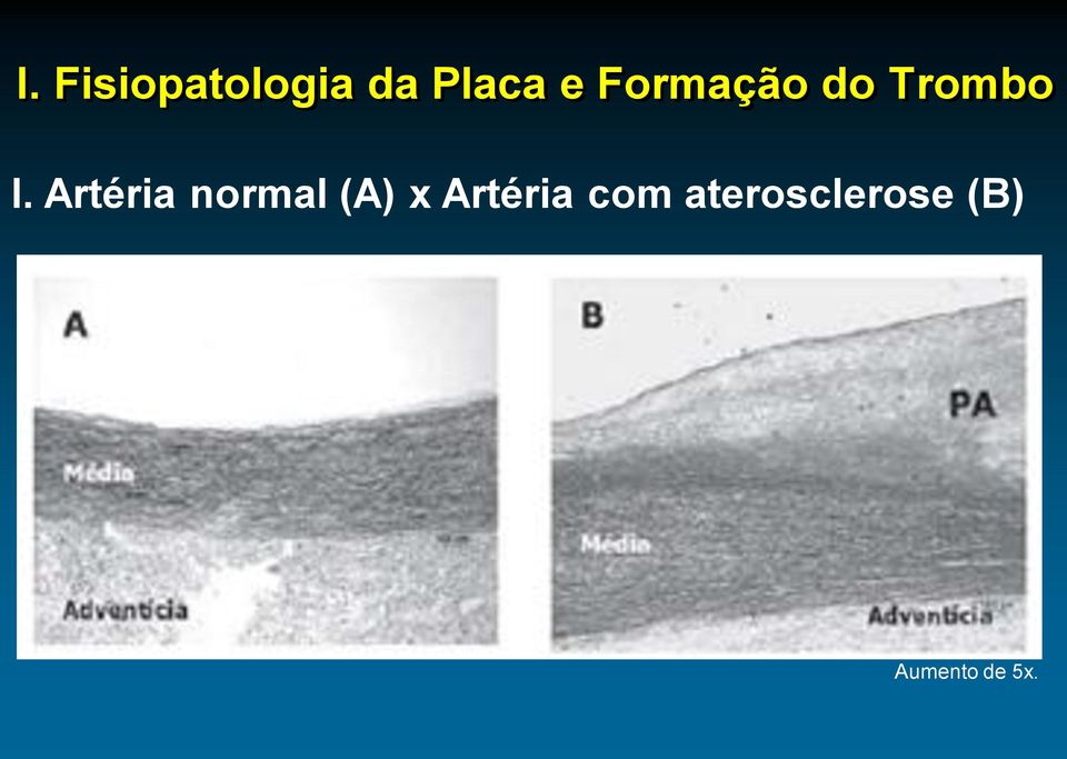 Artéria normal (A) x Artéria