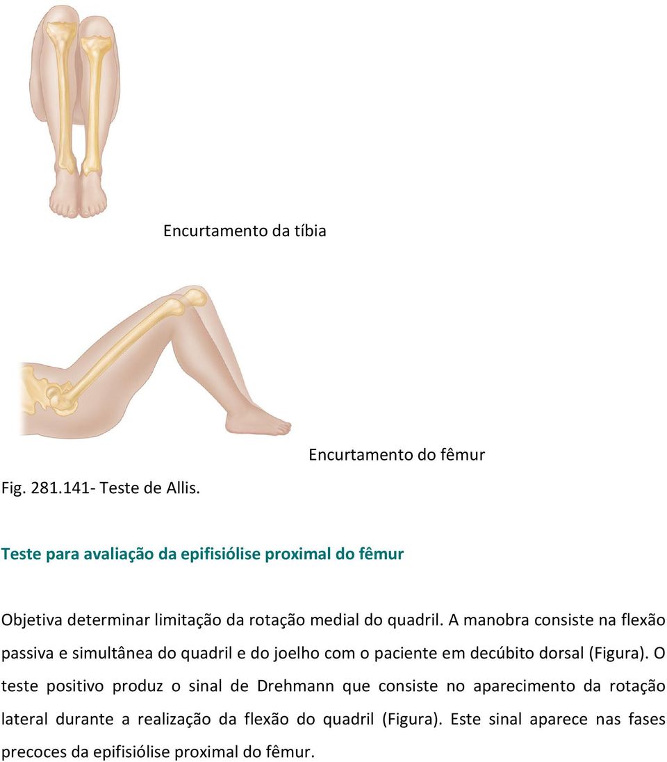 quadril. A manobra consiste na flexão passiva e simultânea do quadril e do joelho com o paciente em decúbito dorsal (Figura).