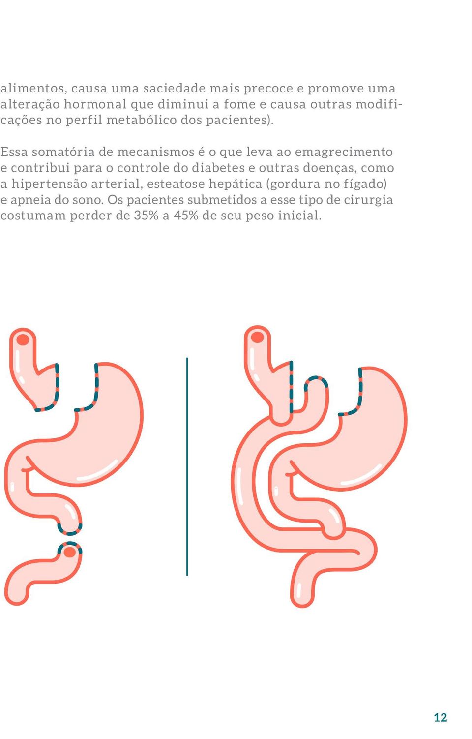 Essa somatória de mecanismos é o que leva ao emagrecimento e contribui para o controle do diabetes e outras