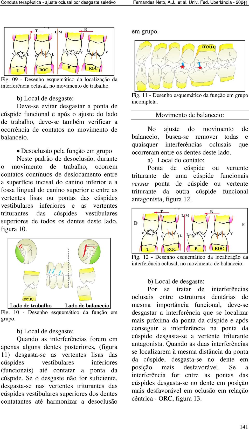 b) ocal de desgaste: Dee-se eitar desgastar a ponta de cúspide funcional e após o ajuste do lado de trabalho, dee-se também erificar a ocorrência de contatos no moimento de balanceio.