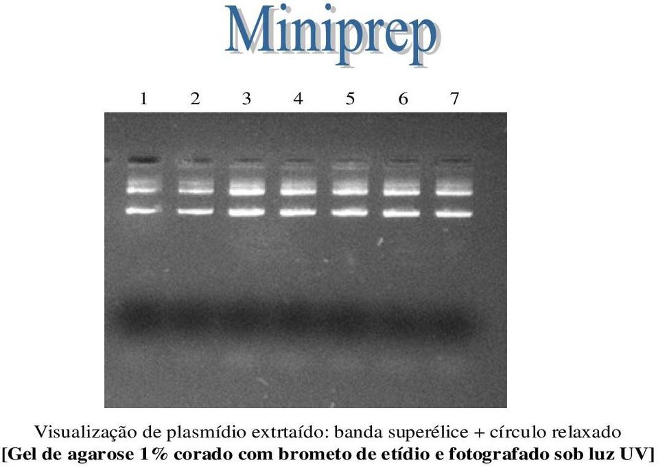 relaxado [Gel de agarose 1% corado com