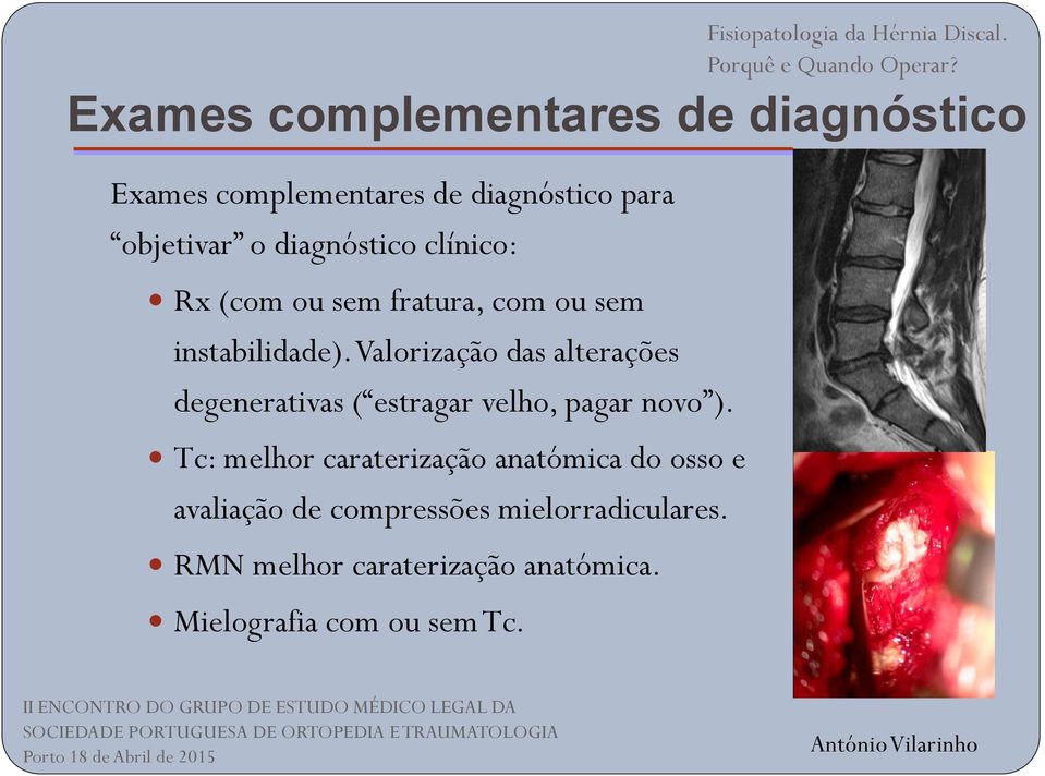 Valorização das alterações degenerativas ( estragar velho, pagar novo ).