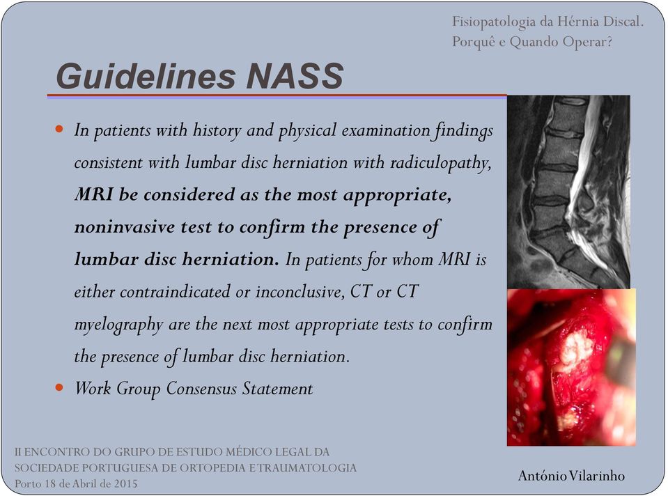 presence of lumbar disc herniation.