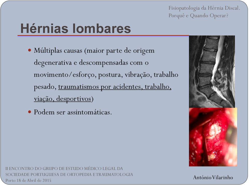 postura, vibração, trabalho pesado, traumatismos por