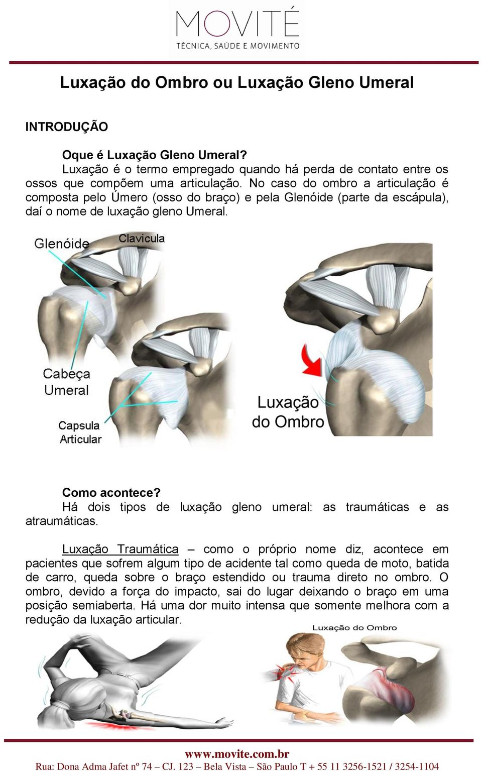 Há dois tipos de luxação gleno umeral: as traumáticas e as atraumáticas.