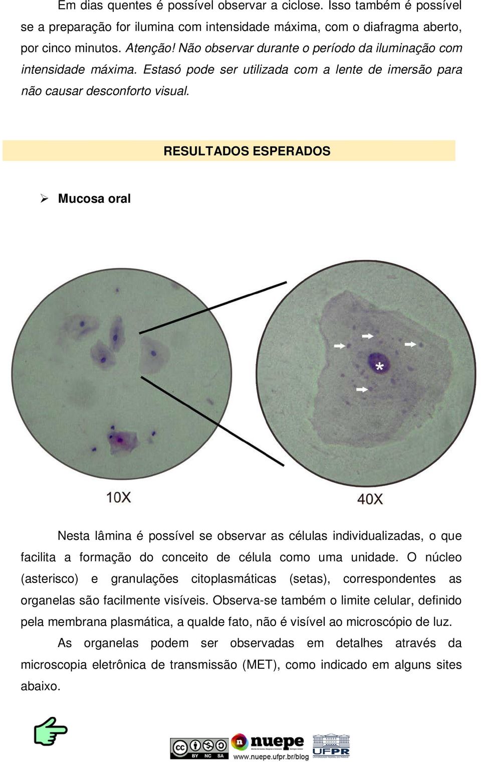 RESULTADOS ESPERADOS Mucosa oral Nesta lâmina é possível se observar as células individualizadas, o que facilita a formação do conceito de célula como uma unidade.