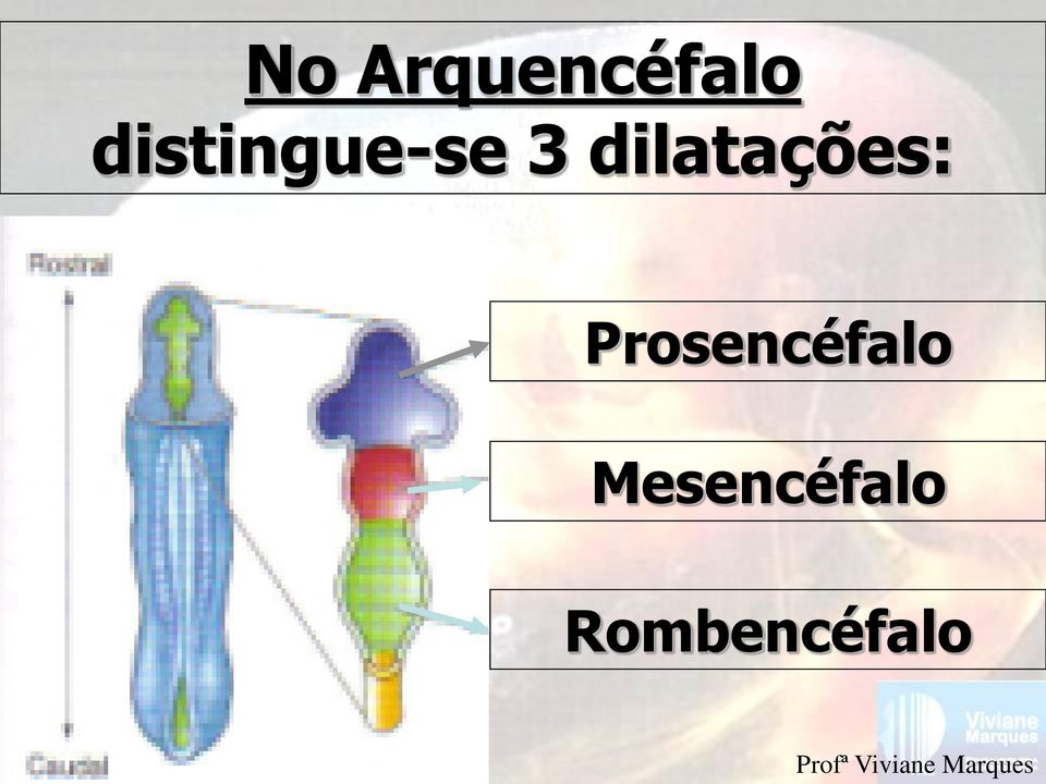 dilatações: Prosencéfalo