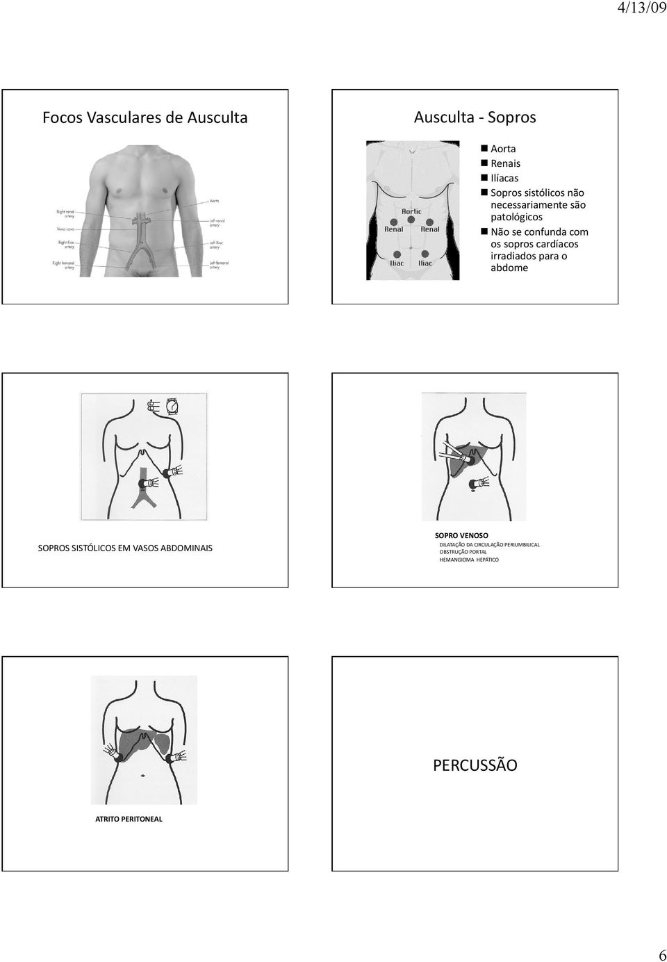 irradiados para o abdome SOPROS SISTÓLICOS EM VASOS ABDOMINAIS SOPRO VENOSO