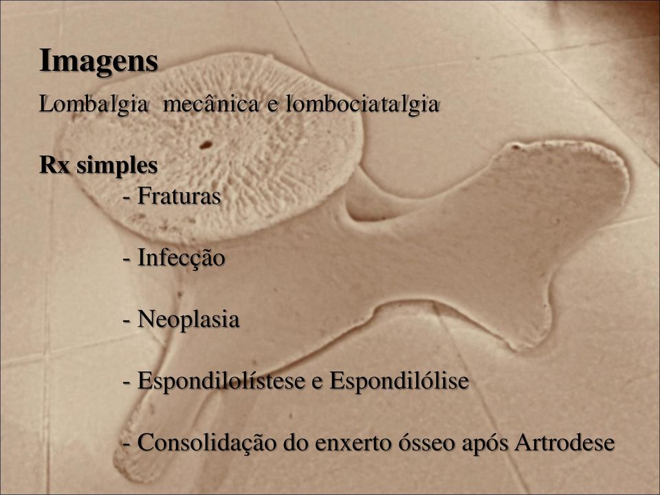Infecção - Neoplasia - Espondilolístese e
