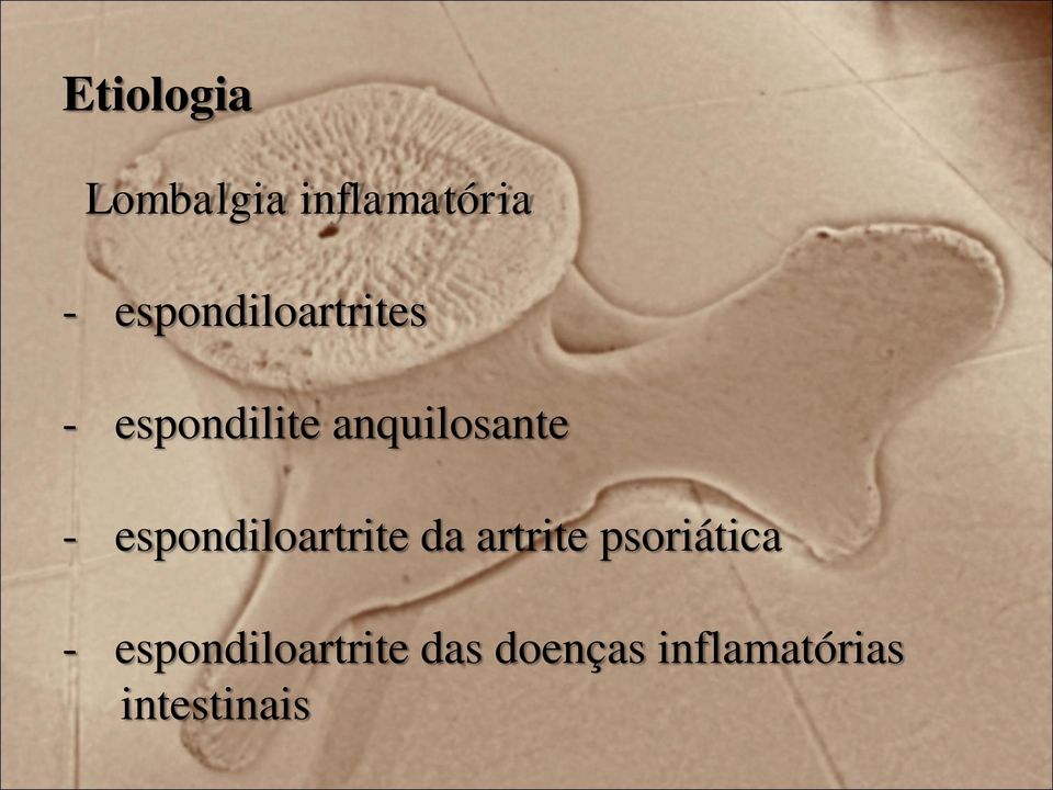 - espondiloartrite da artrite psoriática -