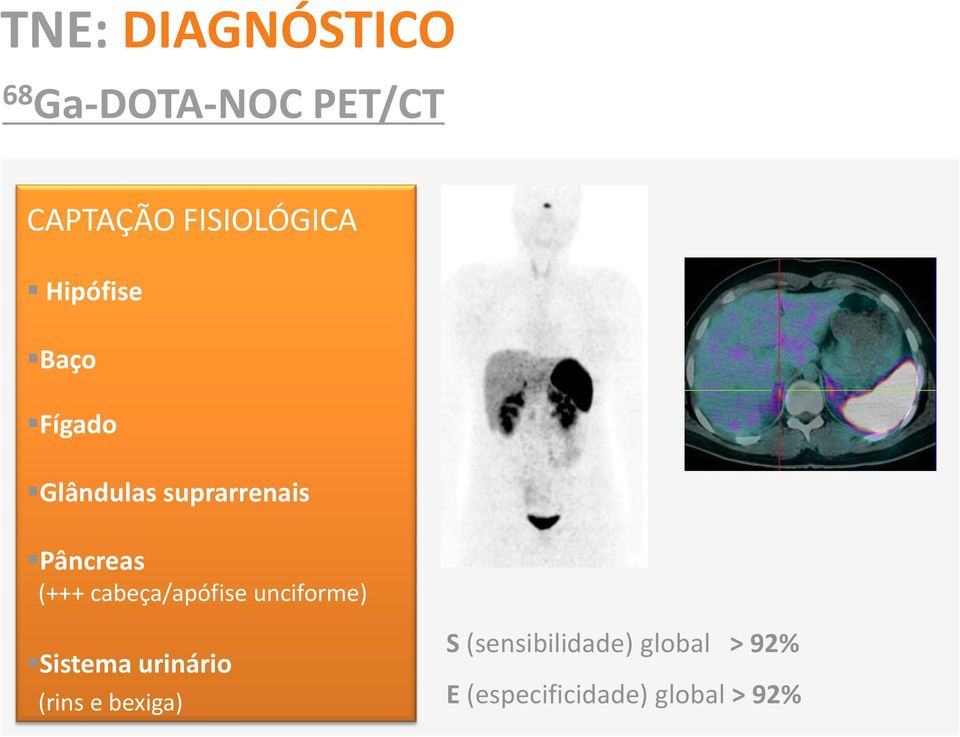 cabeça/apófise unciforme) Sistema urinário (rins e bexiga)