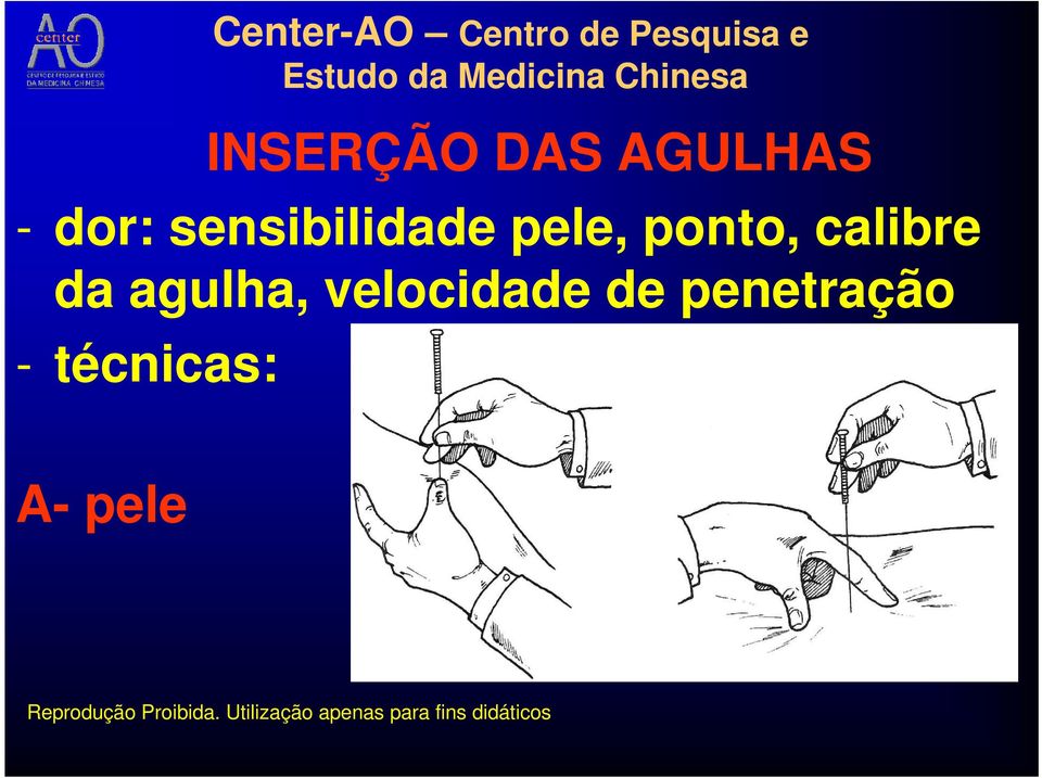 calibre da agulha, velocidade