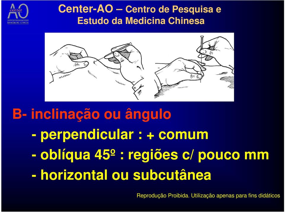 oblíqua 45º : regiões c/