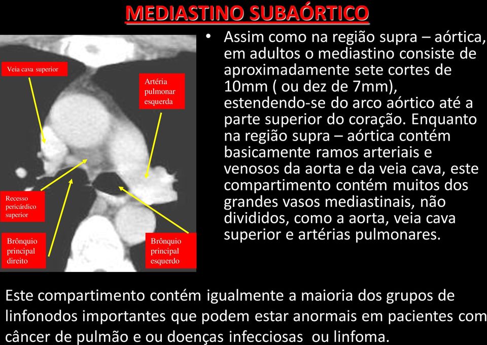 Enquanto na região supra aórtica contém basicamente ramos arteriais e venosos da aorta e da veia cava, este compartimento contém muitos dos grandes vasos mediastinais, não divididos, como a