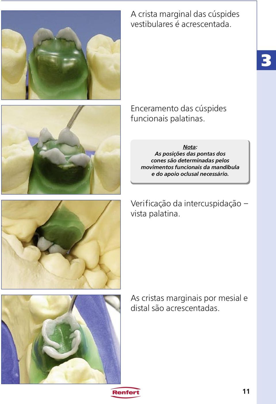 Nota: As posições das pontas dos cones são determinadas pelos movimentos funcionais da