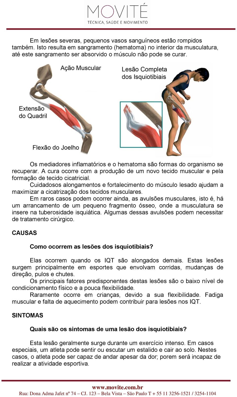 Cuidadosos alongamentos e fortalecimento do músculo lesado ajudam a maximizar a cicatrização dos tecidos musculares.