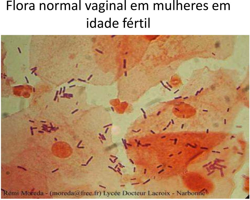 vaginal em