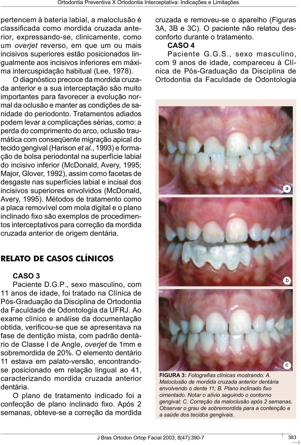 O diagnóstico precoce da mordida cruzada anterior e a sua interceptação são muito importantes para favorecer a evolução normal da oclusão e manter as condições de sanidade do periodonto.