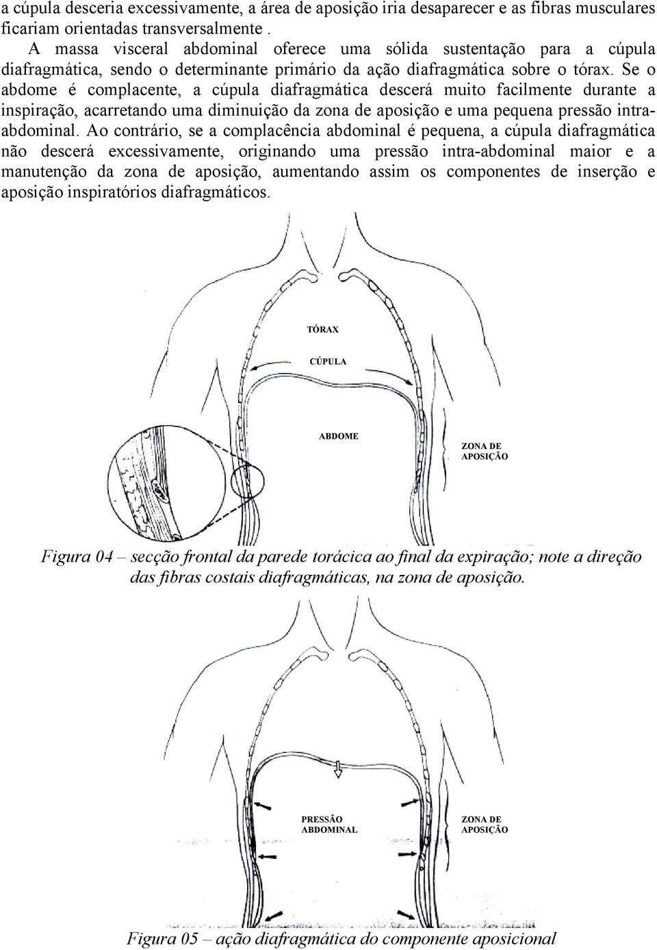 Se o abdome é complacente, a cúpula diafragmática descerá muito facilmente durante a inspiração, acarretando uma diminuição da zona de aposição e uma pequena pressão intraabdominal.