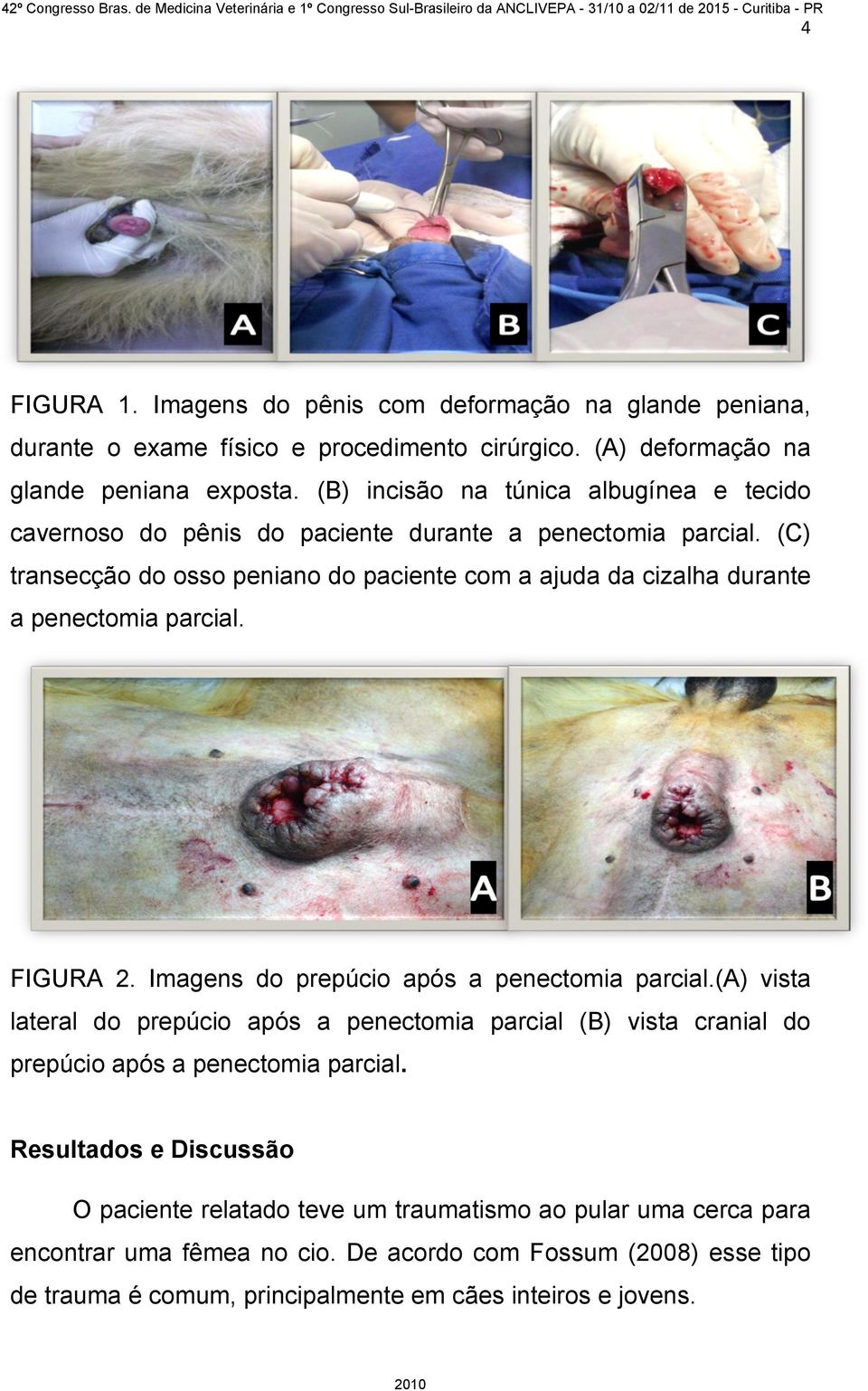 (C) transecção do osso peniano do paciente com a ajuda da cizalha durante a penectomia parcial. FIGURA 2. Imagens do prepúcio após a penectomia parcial.