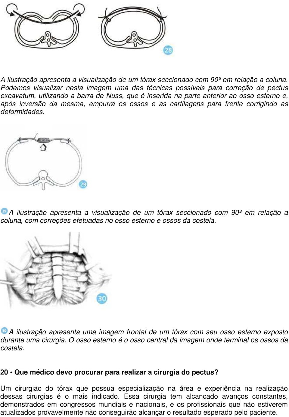 empurra os ossos e as cartilagens para frente corrigindo as deformidades.