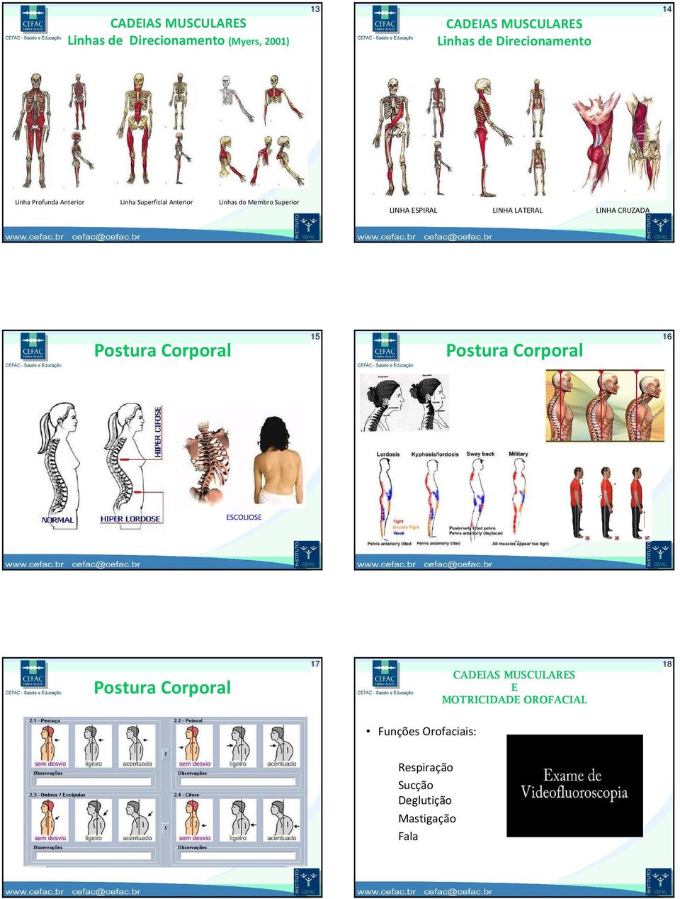 LATERAL LINHA CRUZADA Postura Corporal 15 Postura Corporal 16 ESCOLIOSE Postura