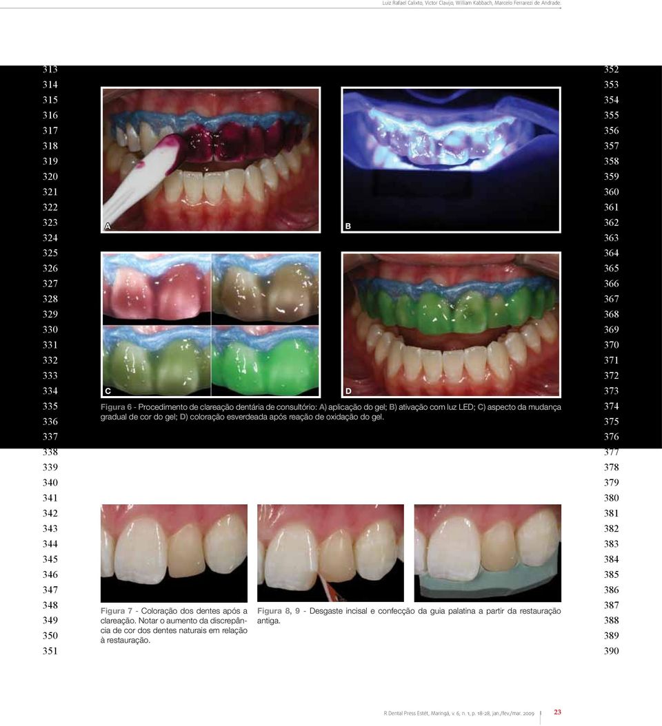 dentária de consultório: A) aplicação do gel; B) ativação com luz LED; C) aspecto da mudança gradual de cor do gel; D) coloração esverdeada após reação de oxidação do gel.