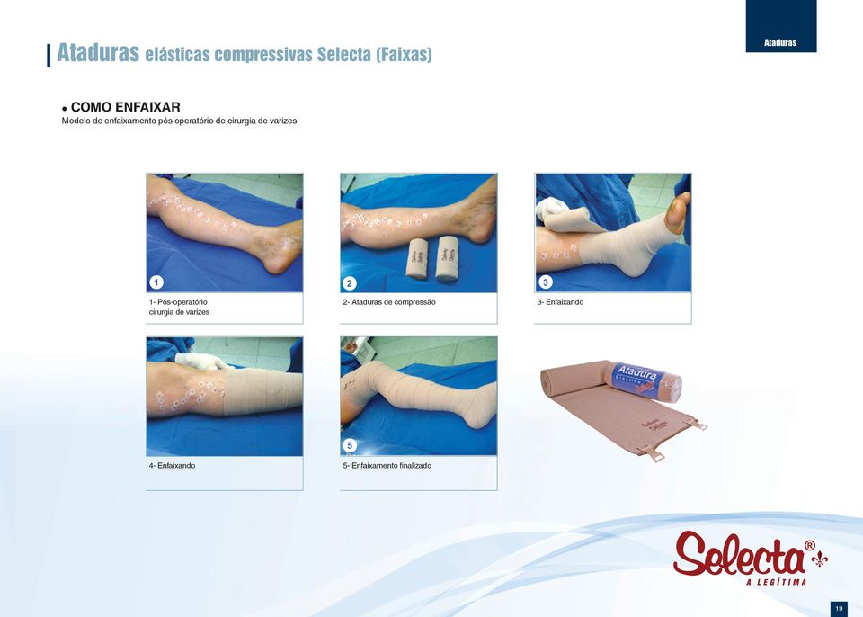 de varizes 1- Pós-operatório cirurgia de varizes 2- Ataduras de