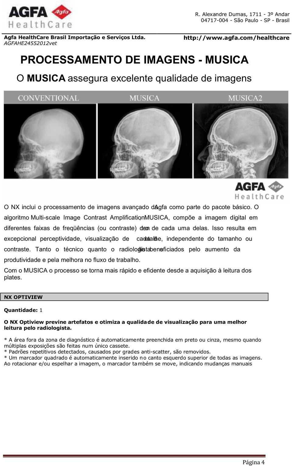 Isso resulta em excepcional perceptividade, visualização de cadeataldhe, independente do tamanho ou contraste.