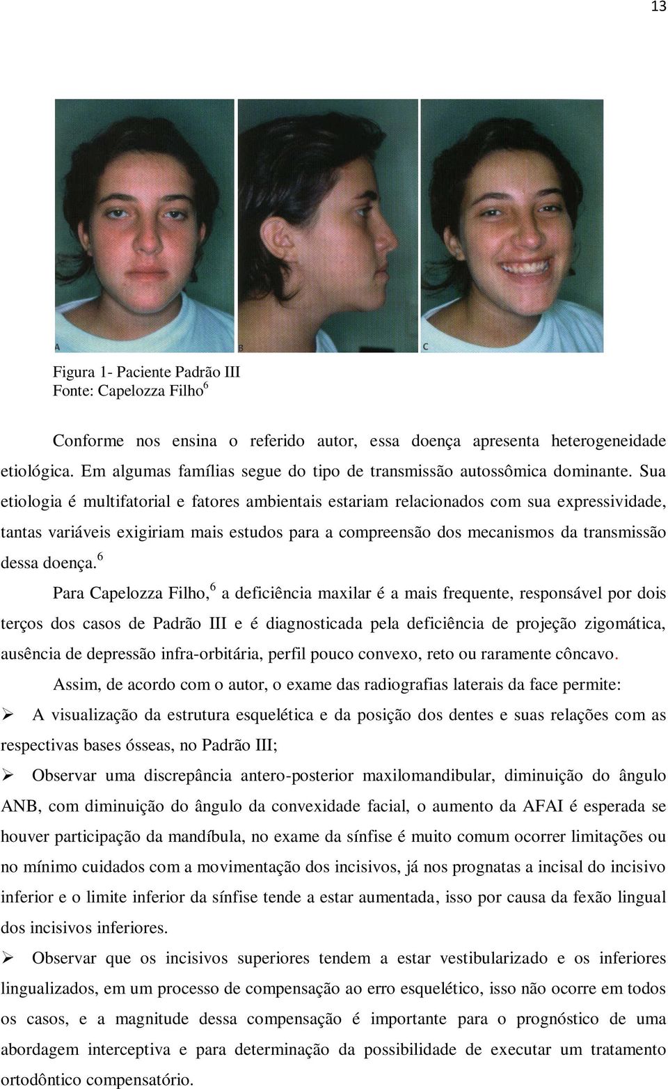 Sua etiologia é multifatorial e fatores ambientais estariam relacionados com sua expressividade, tantas variáveis exigiriam mais estudos para a compreensão dos mecanismos da transmissão dessa doença.