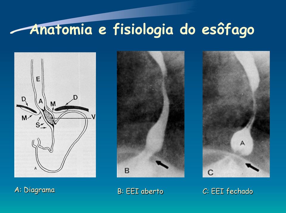 esôfago A: