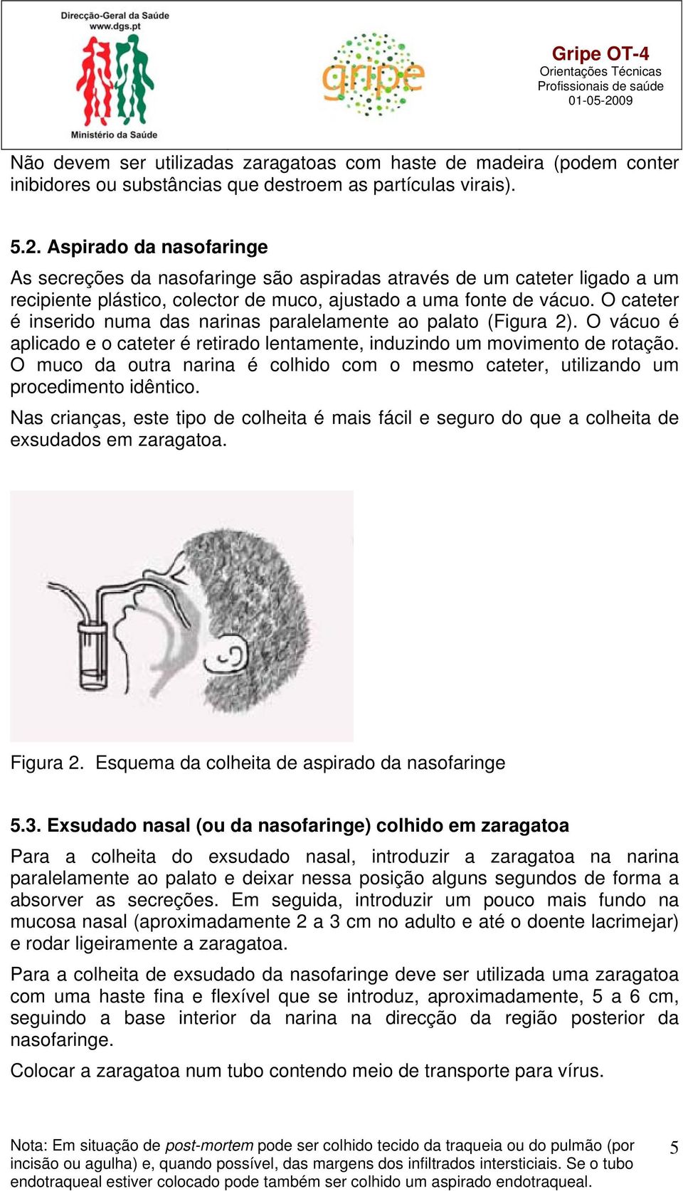 O cateter é inserido numa das narinas paralelamente ao palato (Figura 2). O vácuo é aplicado e o cateter é retirado lentamente, induzindo um movimento de rotação.