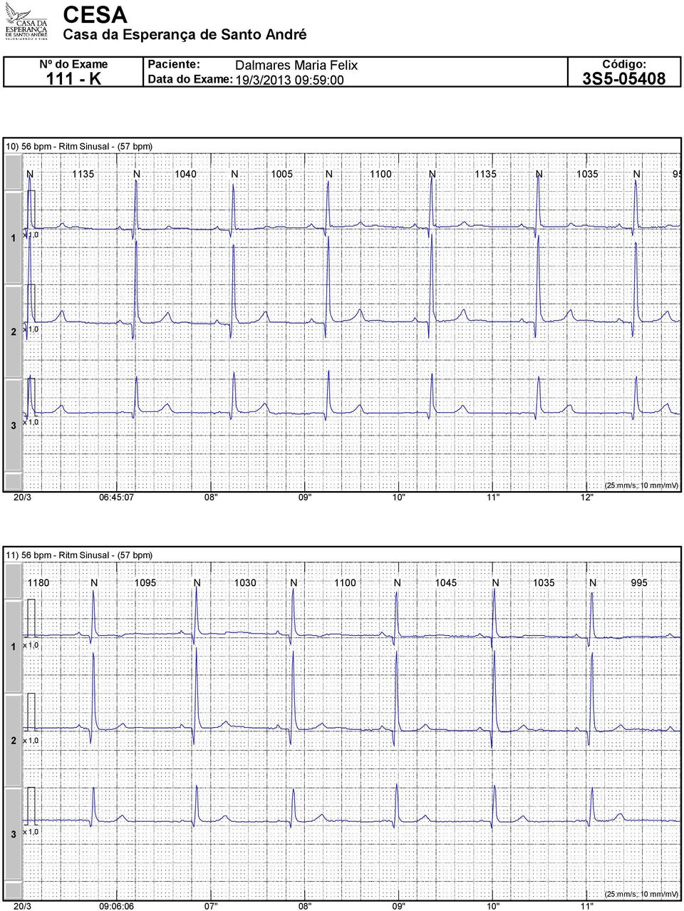 9" " " " (5 mm/s; mm/mv) ) 56 bpm - Ritm Sinusal - (57