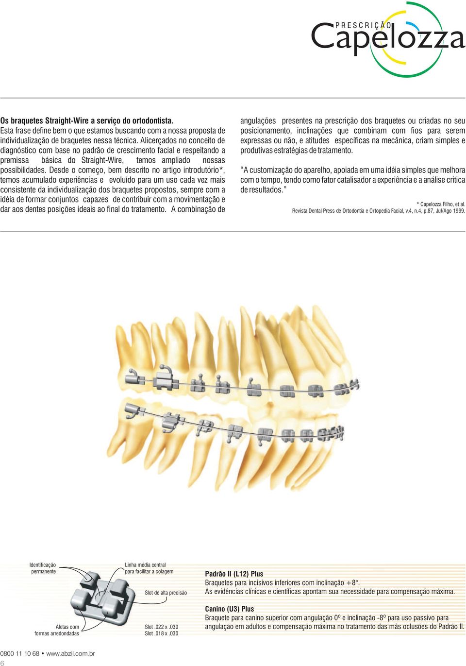 Desde o começo, bem descrito no artigo introdutório*, temos acumulado experiências e evoluído para um uso cada vez mais consistente da individualização dos braquetes propostos, sempre com a idéia de