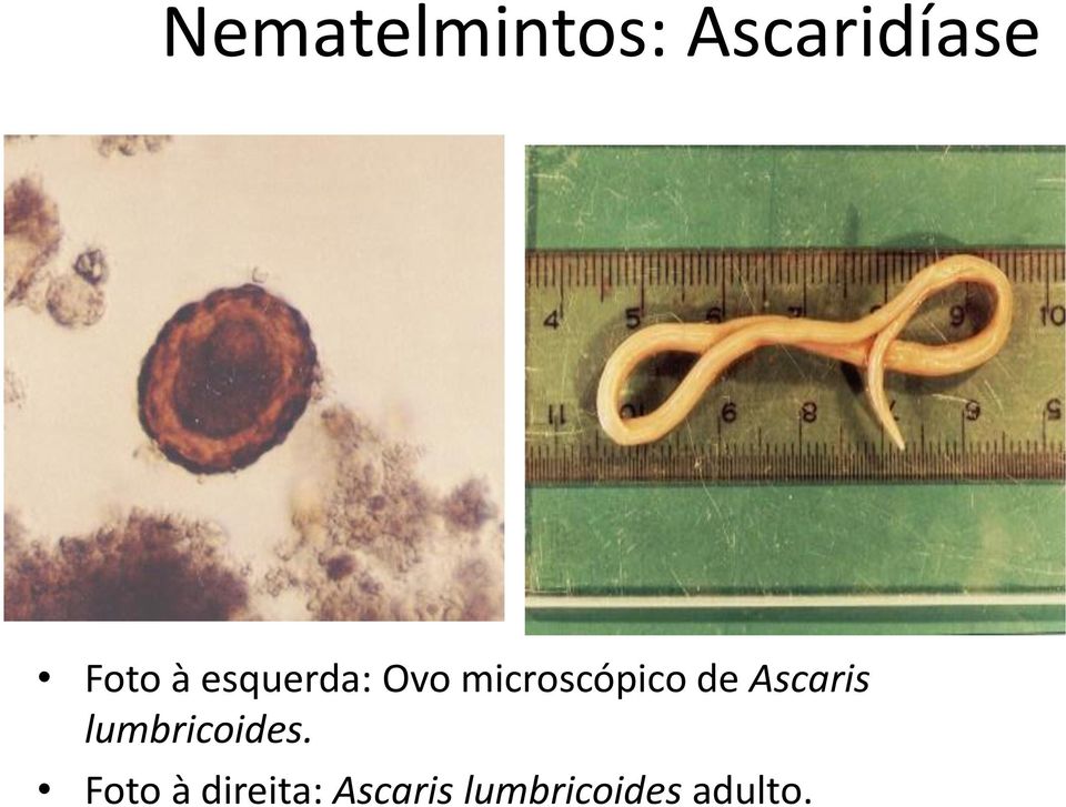 Ascaris lumbricoides.