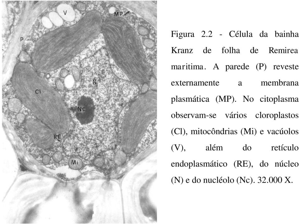 No citoplasma observam-se vários cloroplastos (Cl), mitocôndrias (Mi) e