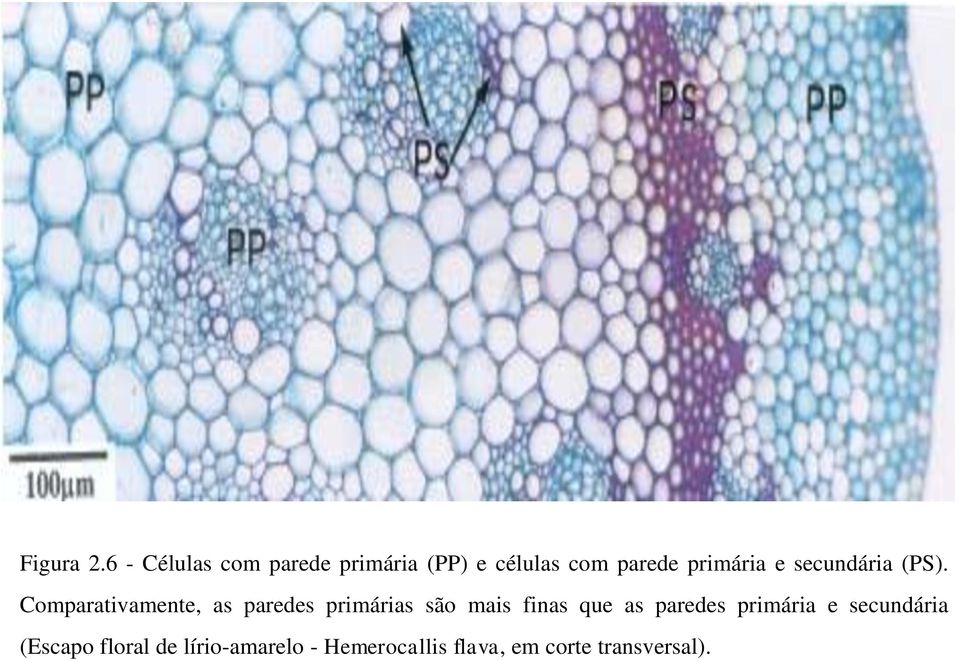 primária e secundária (PS).