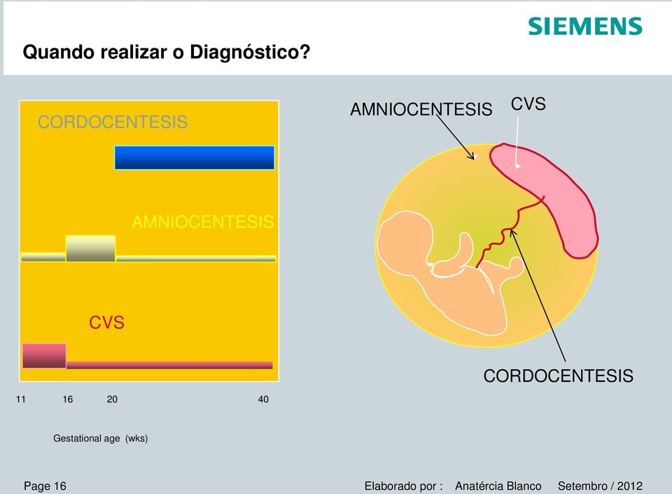 CVS CORDOCENTESIS 11 16 20 40 Gestational age