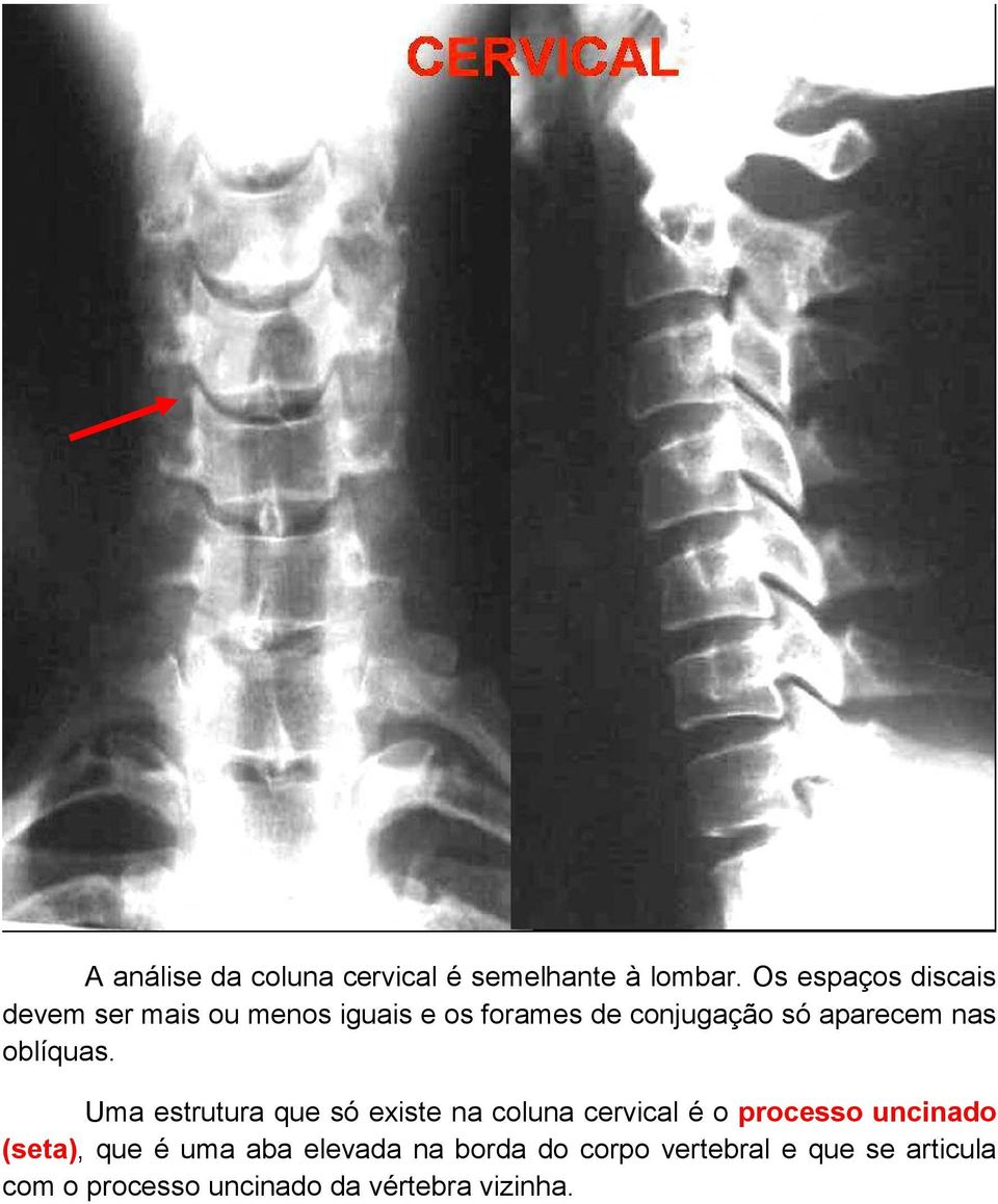 aparecem nas oblíquas.