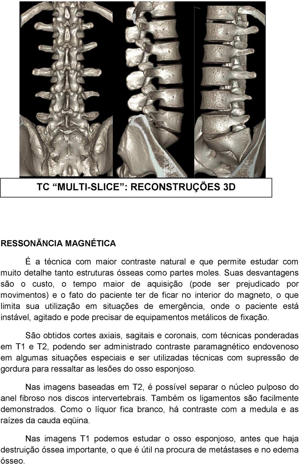 emergência, onde o paciente está instável, agitado e pode precisar de equipamentos metálicos de fixação.