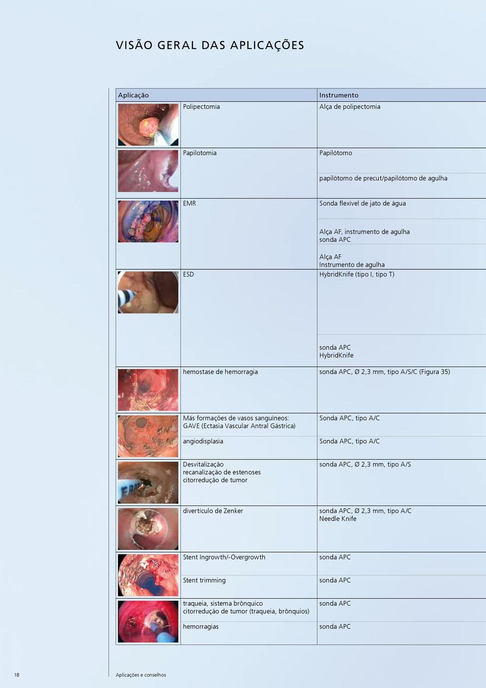 de vasos sanguíneos: GAVE (Ectasia Vascular Antral Gástrica) angiodisplasia Sonda APC, tipo A/C Sonda APC, tipo A/C Desvitalização recanalização de estenoses citorredução de tumor sonda APC, Ø 2,3