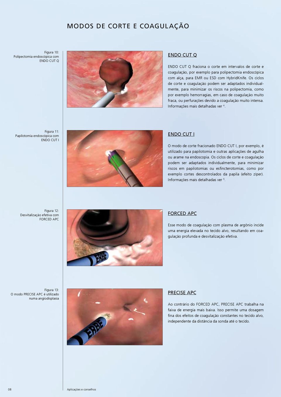 Os ciclos de corte e coagulação podem ser adaptados individualmente, para minimizar os riscos na polipectomia, como por exemplo hemorragias, em caso de coagulação muito fraca, ou perfurações devido a