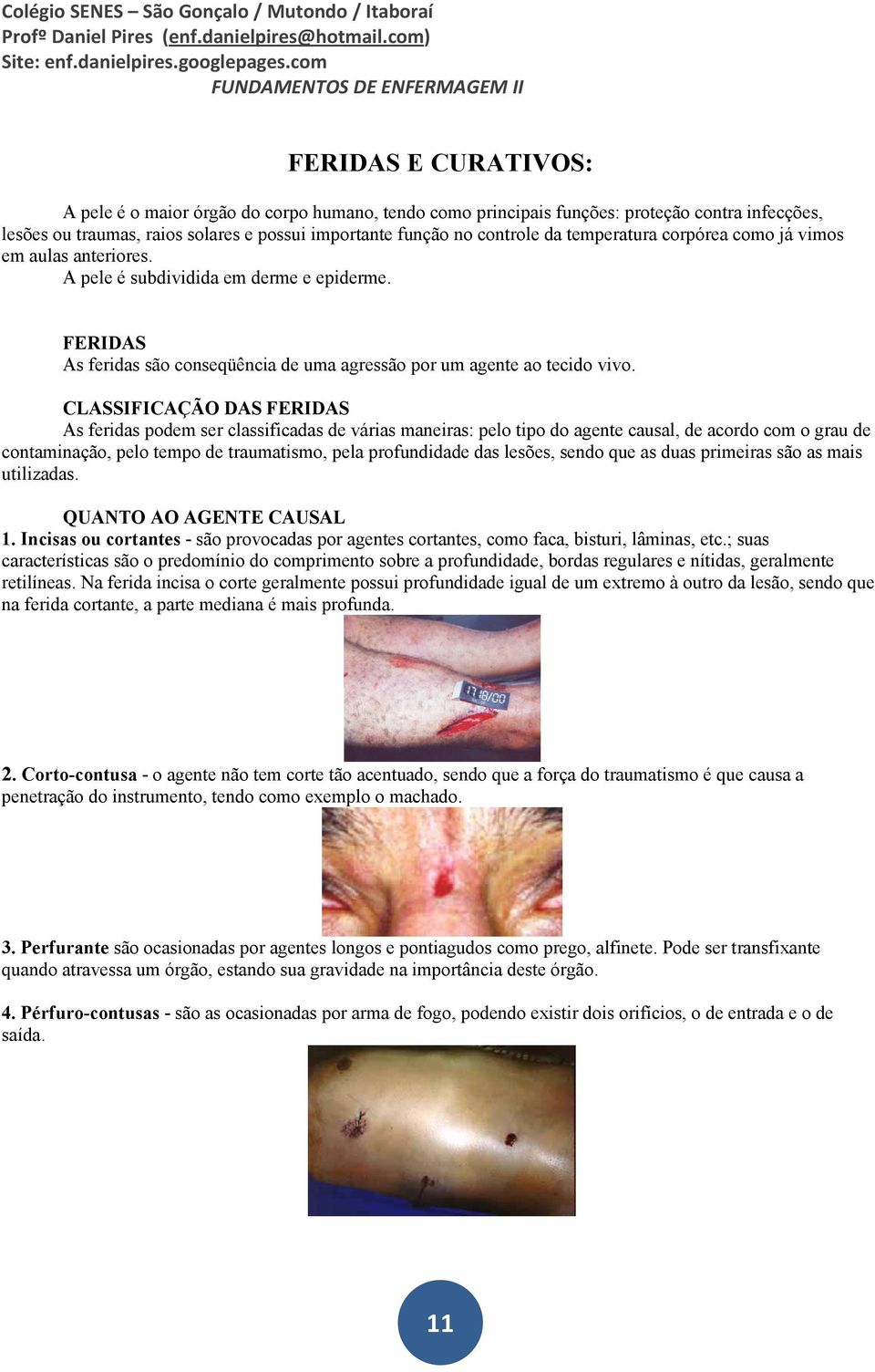 CLASSIFICAÇÃO DAS FERIDAS As feridas podem ser classificadas de várias maneiras: pelo tipo do agente causal, de acordo com o grau de contaminação, pelo tempo de traumatismo, pela profundidade das