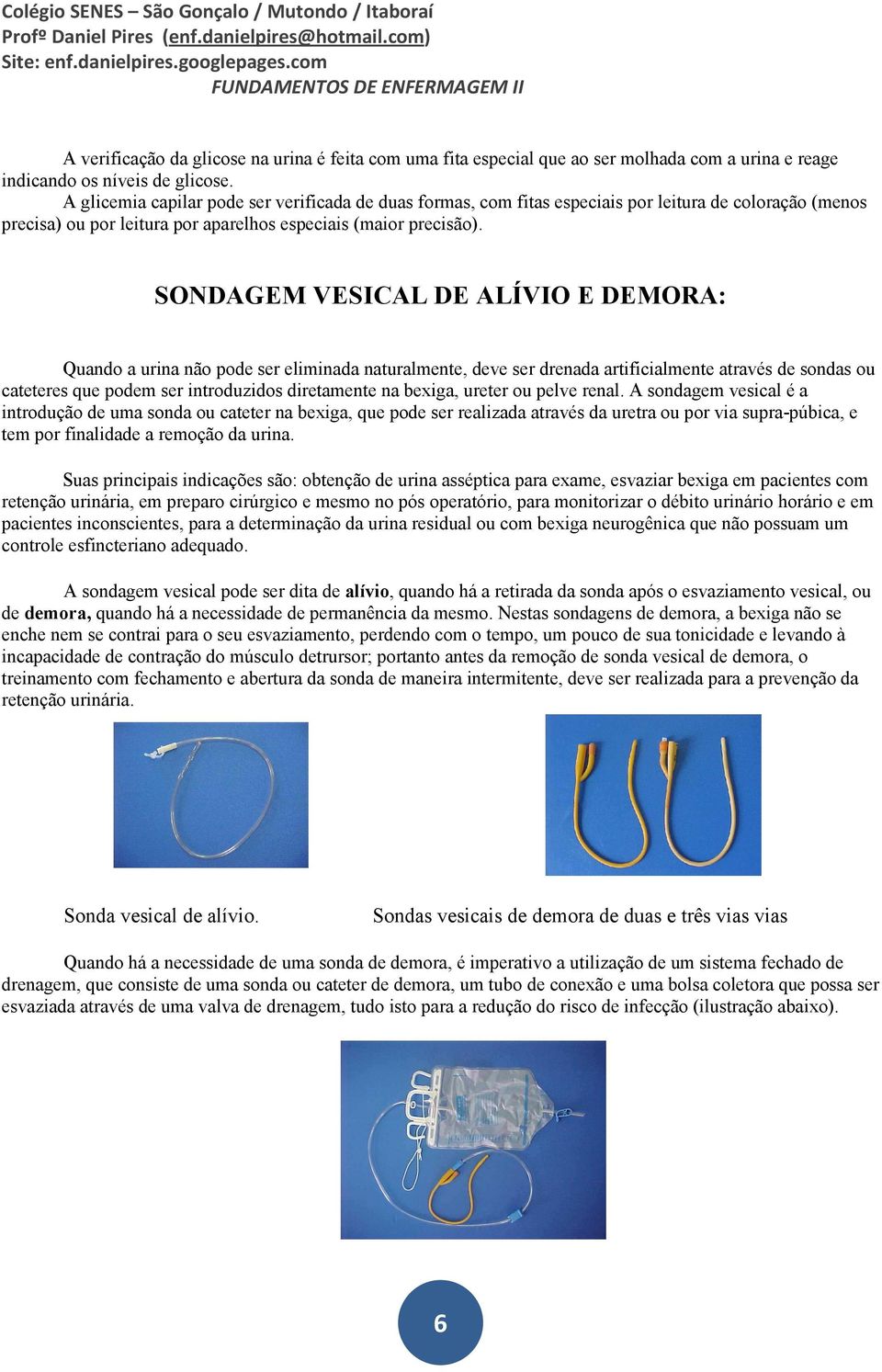 SONDAGEM VESICAL DE ALÍVIO E DEMORA: Quando a urina não pode ser eliminada naturalmente, deve ser drenada artificialmente através de sondas ou cateteres que podem ser introduzidos diretamente na